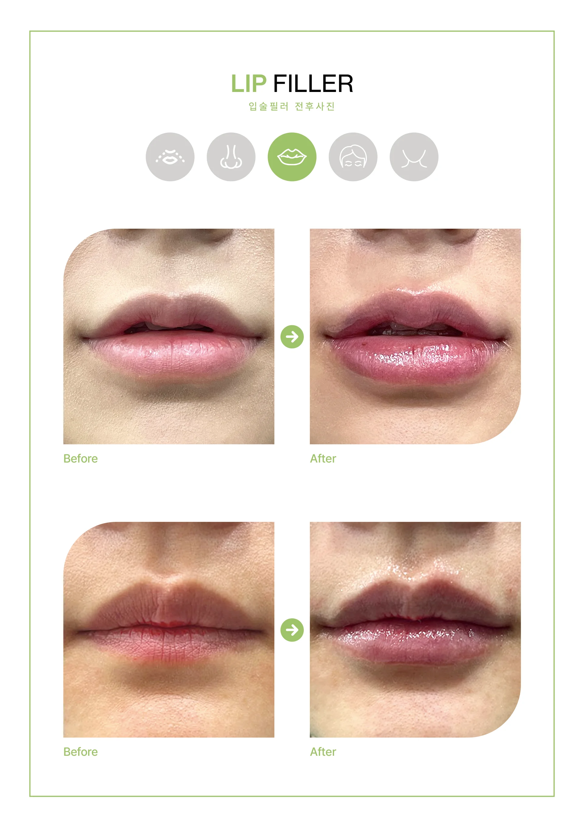Clinic treatment comparison poster 2