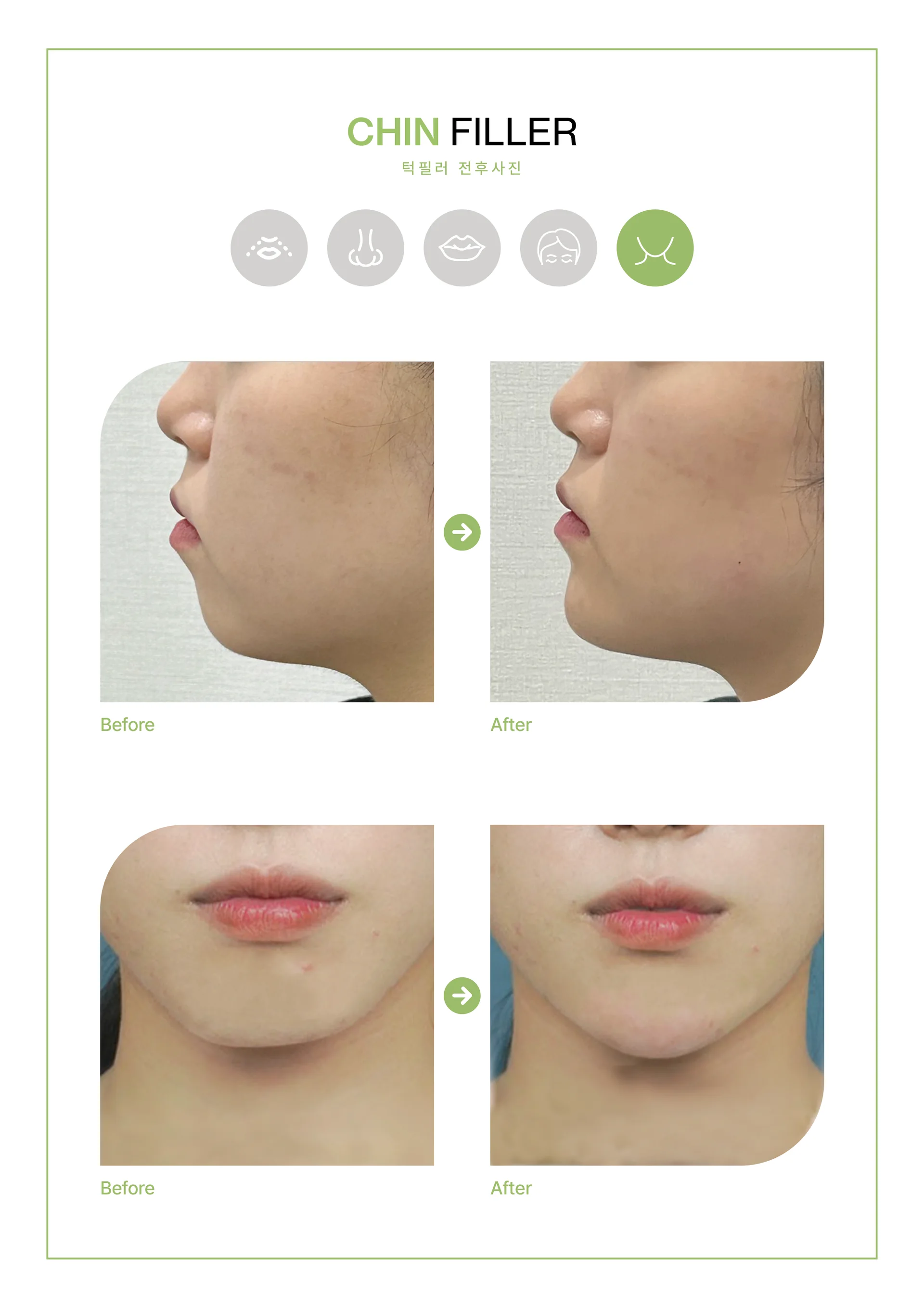 Clinic treatment comparison poster 3