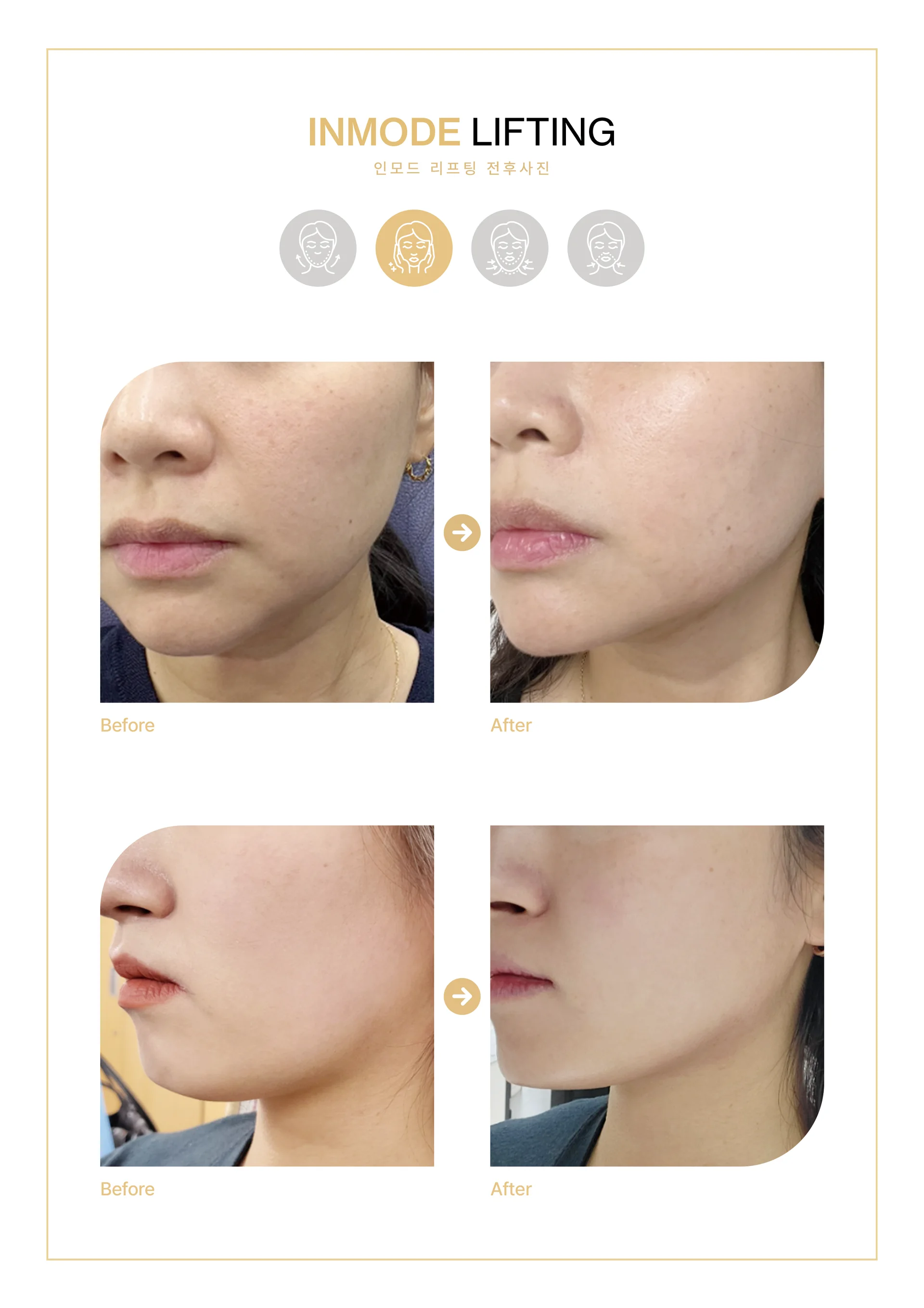 Clinic treatment comparison poster 5