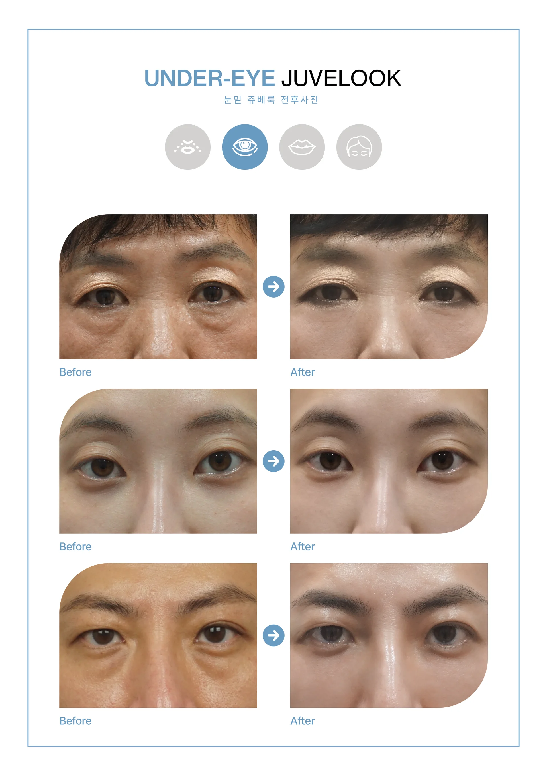 Clinic treatment comparison poster 6