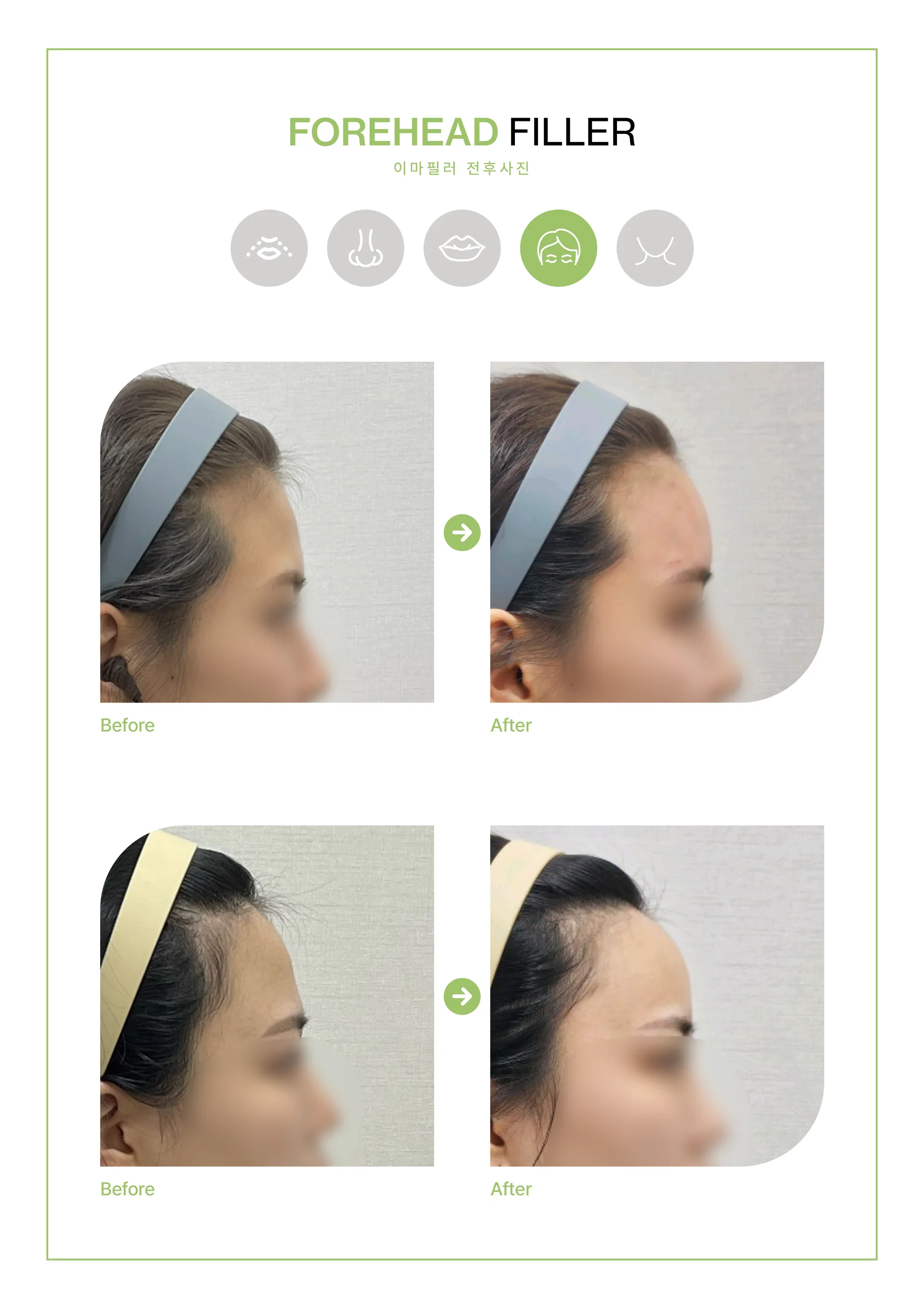 Clinic treatment comparison poster 8
