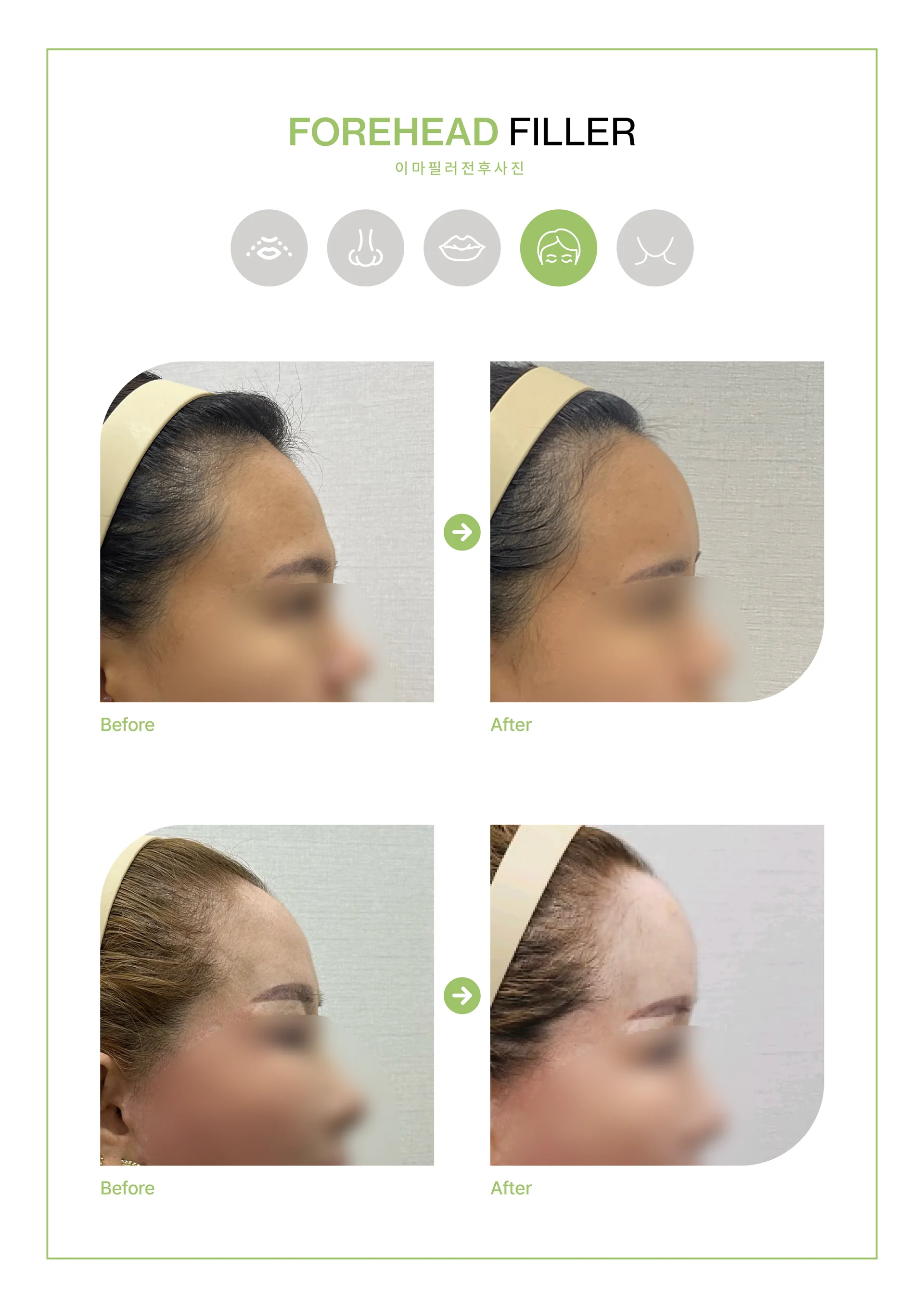 Clinic treatment comparison poster 9