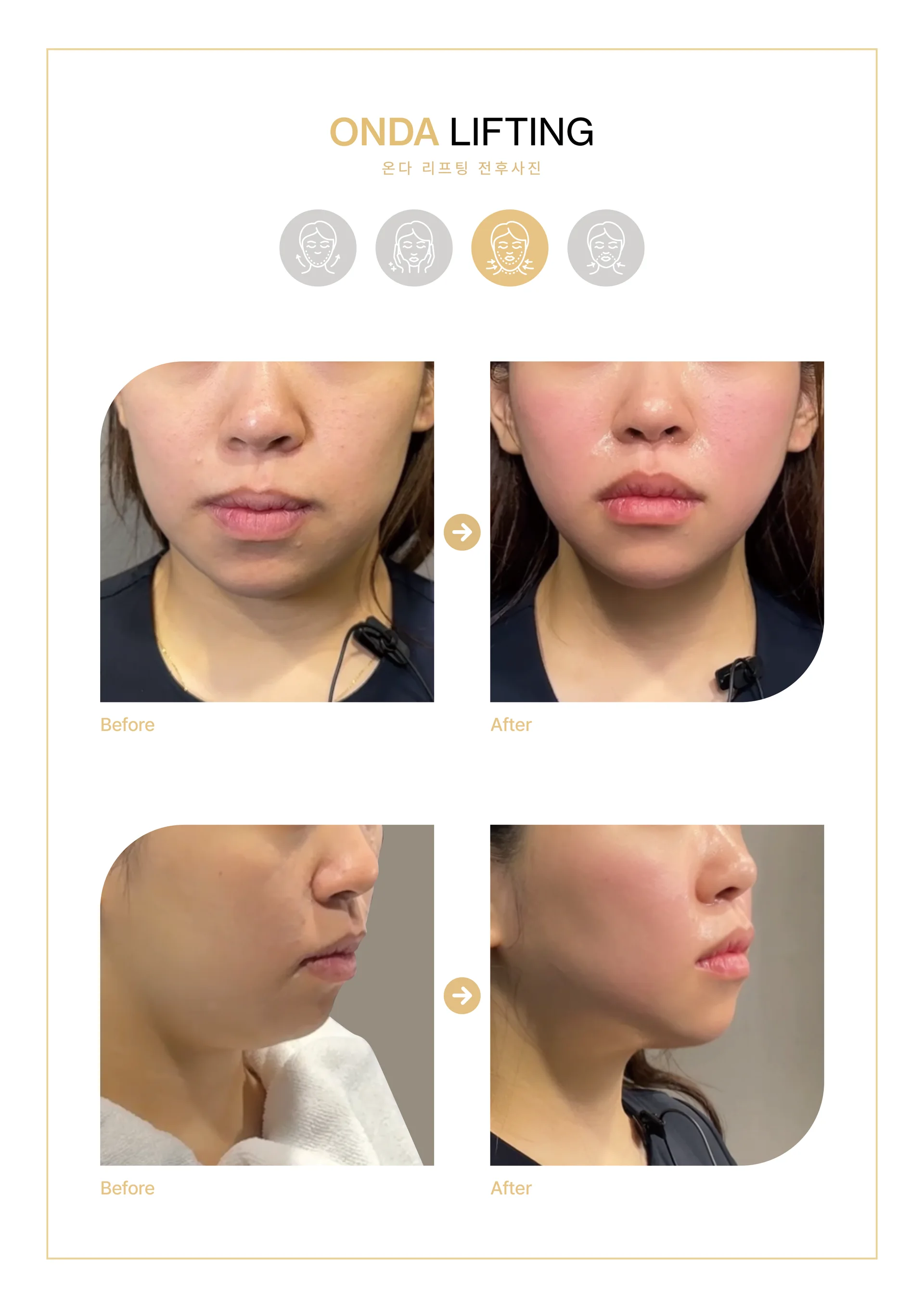 Clinic treatment comparison poster 10